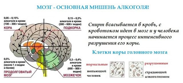 Preview Повышенная уязвимость женского мозга к алкоголю: объяснение ученых