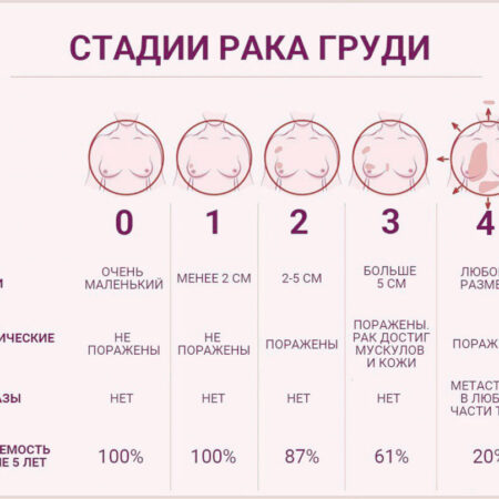 Стал известен способ распознать рак за три года до симптомов