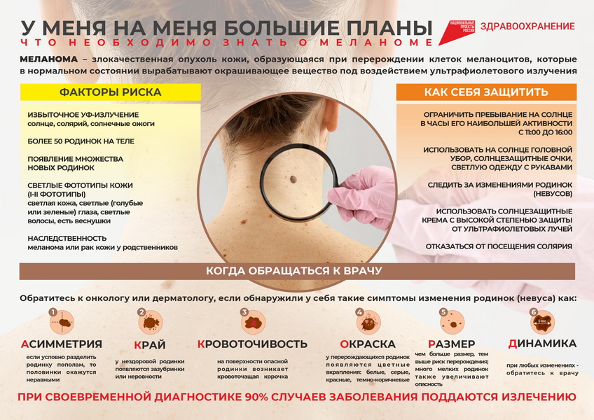 Preview Обнаружен новый подход к борьбе с агрессивной меланомой