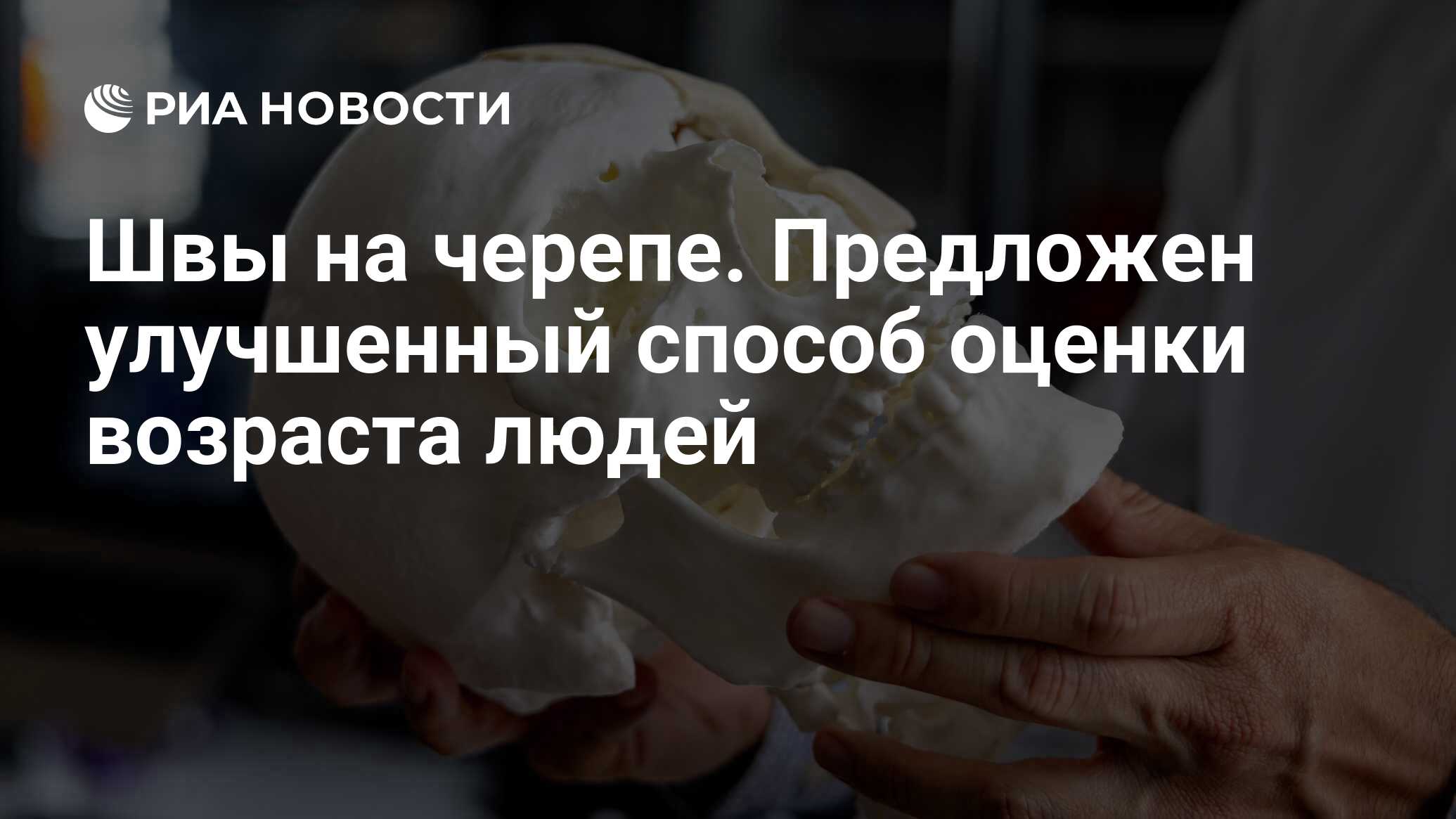 Preview Швы на черепе. Предложен улучшенный способ оценки возраста людей