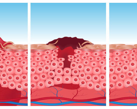 Раскрыт механизм быстрой регенерации кожи