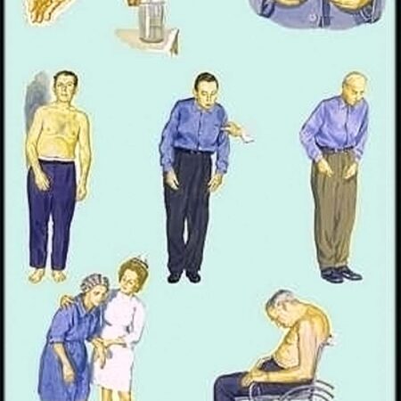 Театр улучшает эмоциональное состояние при болезни Паркинсона