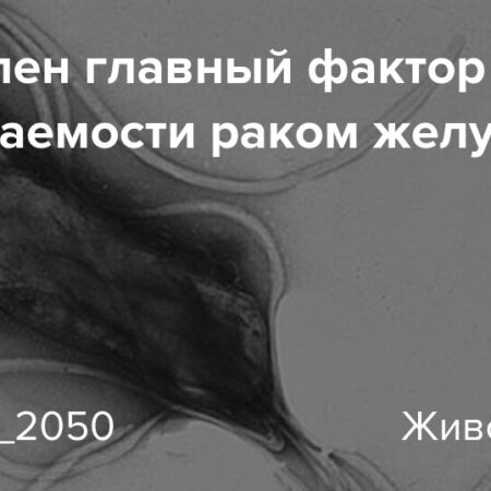 Исследование назвало главную причину роста заболеваемости раком желудка