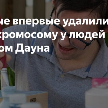 Японские ученые впервые удалили лишнюю хромосому у людей с синдромом Дауна