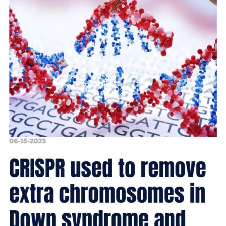 Прорыв в лечении синдрома Дауна: CRISPR-технология удаляет лишнюю хромосому
