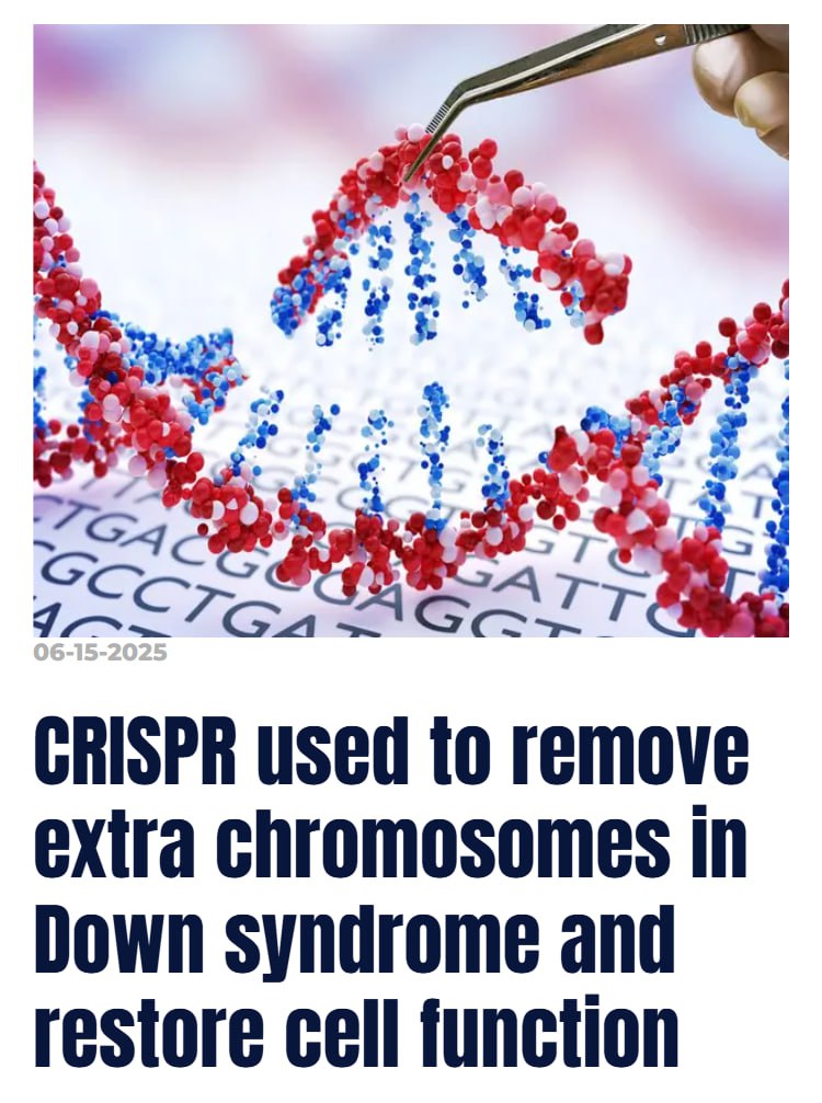 Preview Прорыв в лечении синдрома Дауна: CRISPR-технология удаляет лишнюю хромосому