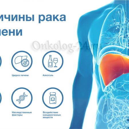 Основные Причины Рака Печени: Профилактика и Прогнозы