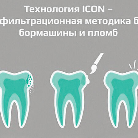 Прорыв в стоматологии: Новый метод раннего предсказания кариеса