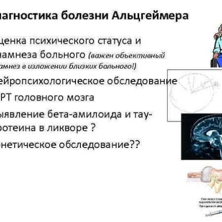 Прорыв в диагностике: Мозг выдает ранние признаки Альцгеймера