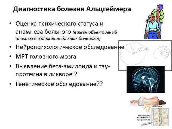 Preview Прорыв в диагностике: Мозг выдает ранние признаки Альцгеймера