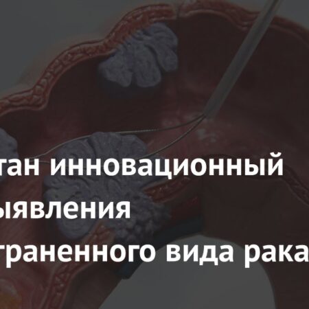 Инновационный метод раннего выявления распространенного вида рака