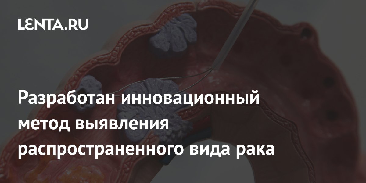 Preview Инновационный метод раннего выявления распространенного вида рака