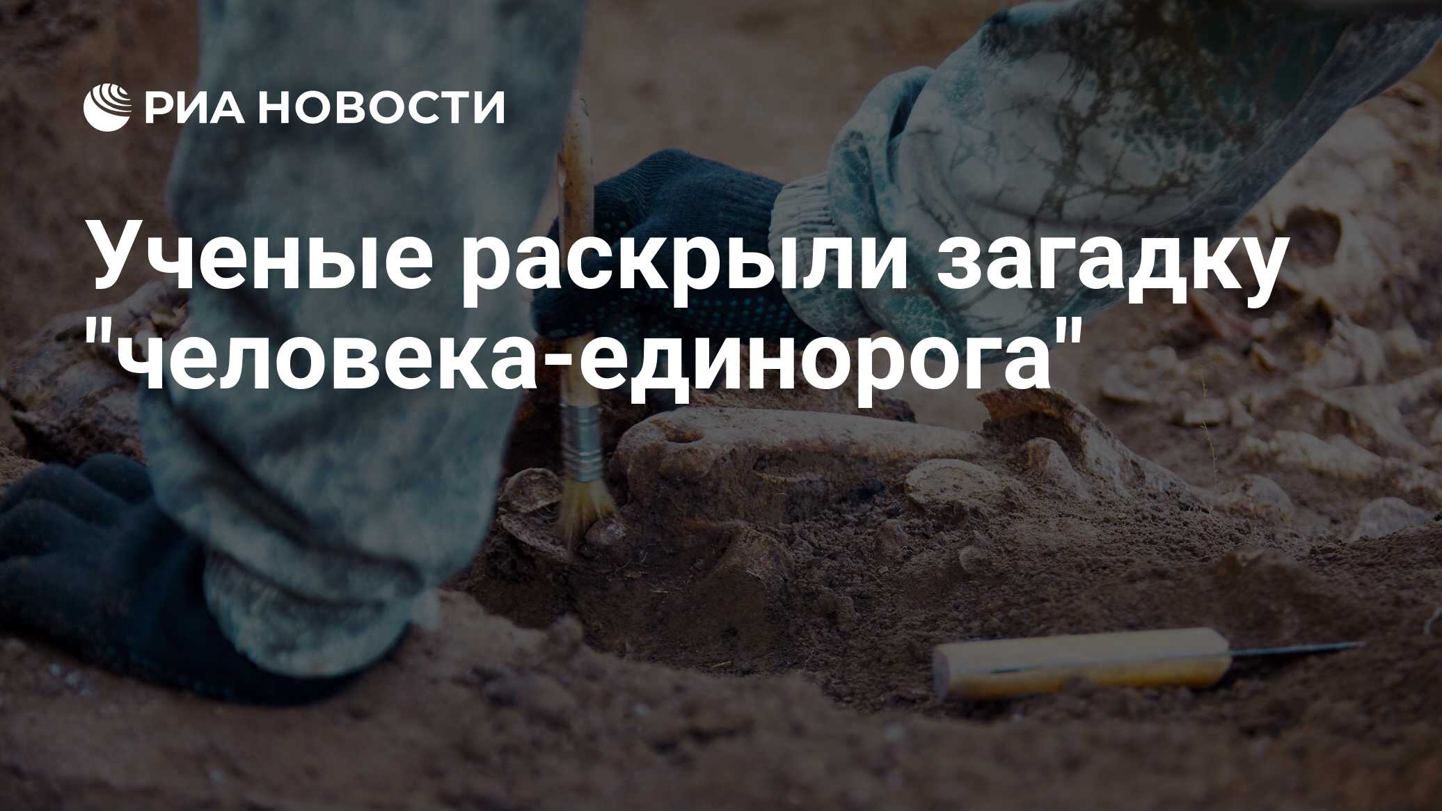 Preview Ученые раскрыли загадку «человека-единорога»