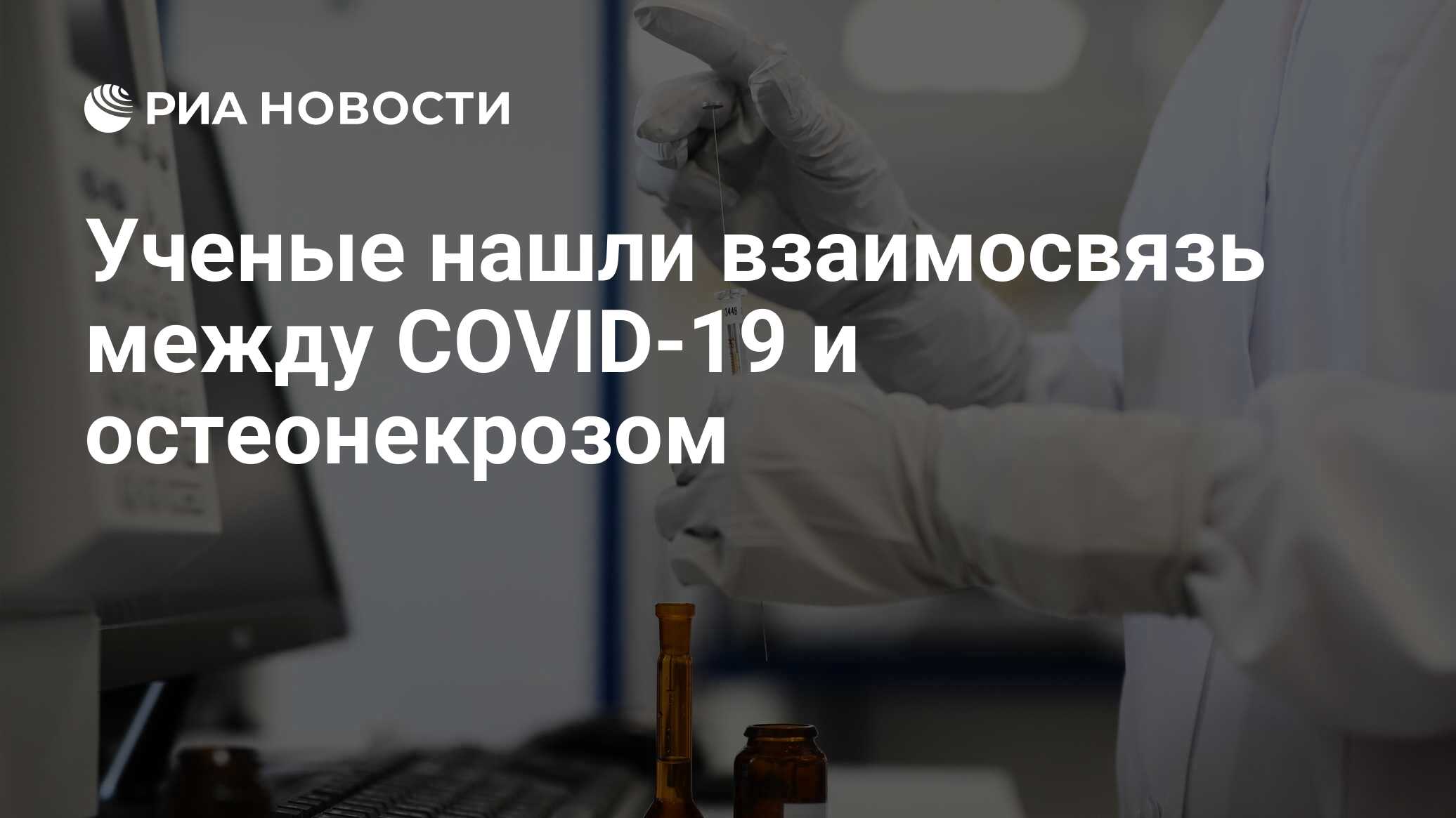 Preview В России выявили опасное последствие COVID-19: Остеонекроз бедренной кости