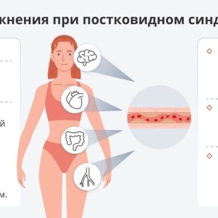 Простой метод борьбы с постковидным синдромом: роль физических нагрузок