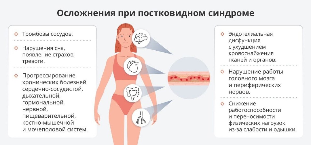 Preview Простой метод борьбы с постковидным синдромом: роль физических нагрузок