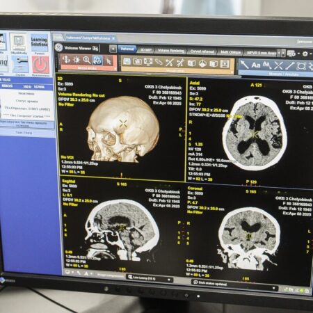 Плохой сон ускоряет старение мозга, выяснили ученые