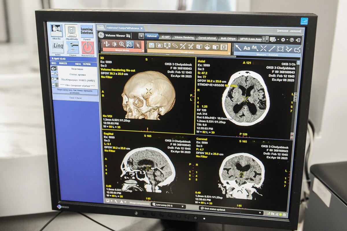 Preview Плохой сон ускоряет старение мозга, выяснили ученые