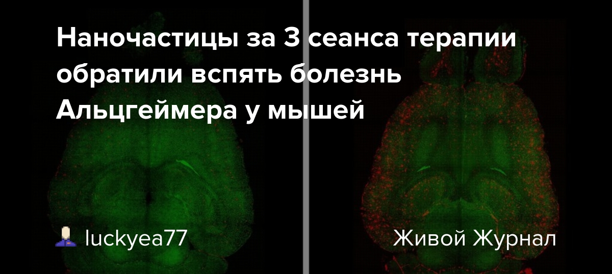 Preview Революция в лечении: Наночастицы обращают вспять болезнь Альцгеймера