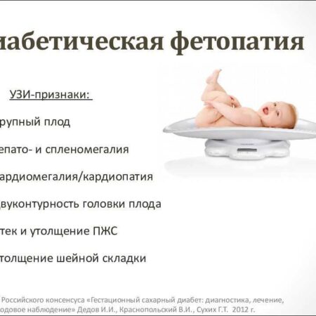 Ученые выявили новый тип диабета, поражающий младенцев