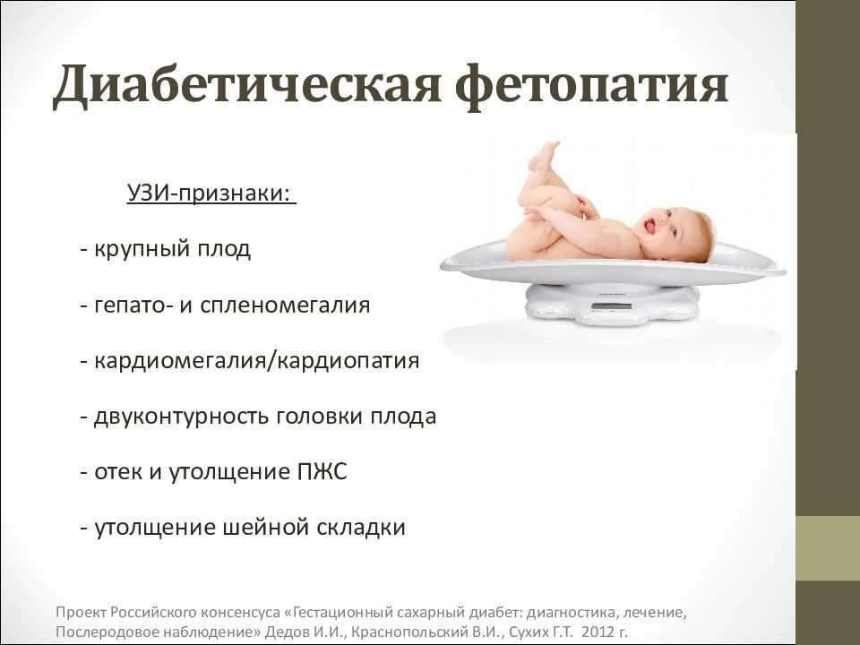 Preview Ученые выявили новый тип диабета, поражающий младенцев