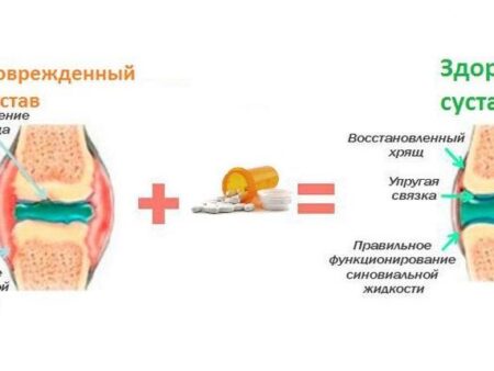 В России открыт инновационный метод полного восстановления хрящевых тканей