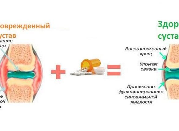 В России открыт инновационный метод полного восстановления хрящевых тканей