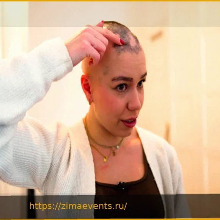 Очаговая алопеция: Как стресс влияет на корни волос